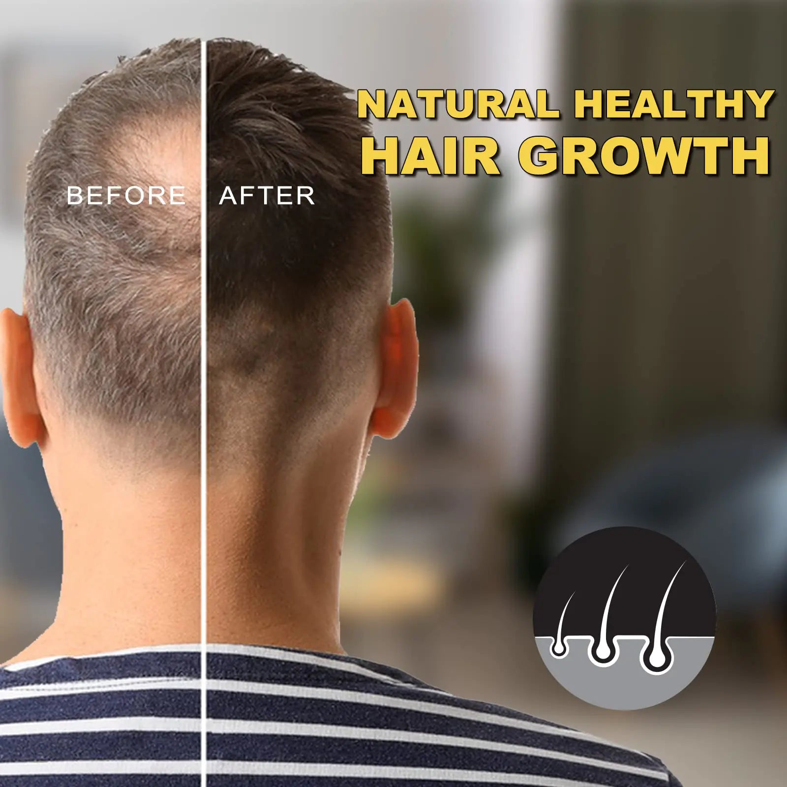 Before and after results of hair growth using natural treatment, showcasing thicker hair in a comparison format.